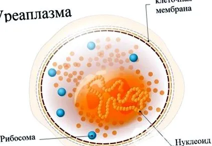 ureaplasma ureaplasma