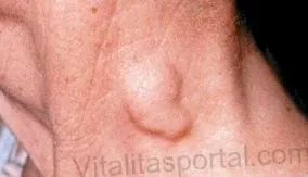 симптоми симптоми