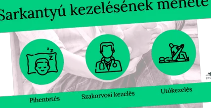 стопи стопи