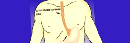 хранопроводният опасен