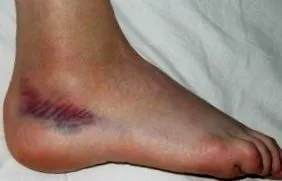 наранявания наранявания