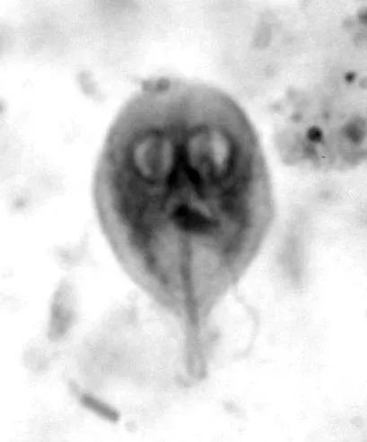 detection