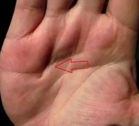 fizioterapie fizioterapie