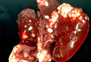 detosil рецензии