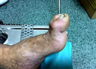 лечение ставите
