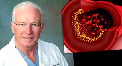 cardiac chirurg