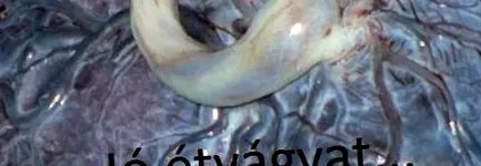 тази тема плацента