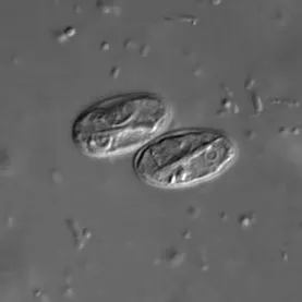 objawy giardia
