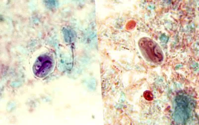 giardia пляма
