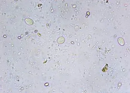 fereg giardia