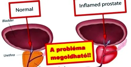 pentru medicamente