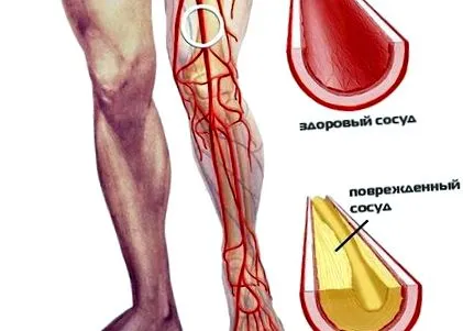 ставите ставите