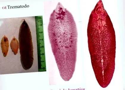 helmintus trematodes
