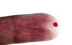 бърз celiac