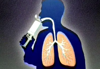 injector