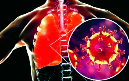 coronavirus sunt
