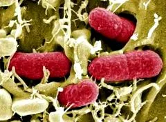 sunt intestinale