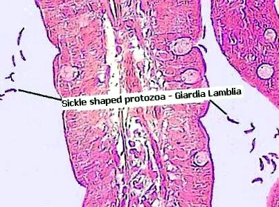 digestive