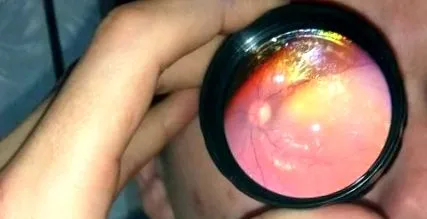 лечение лечение