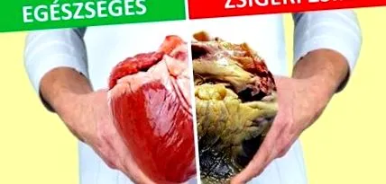 viscerală grăsimea
