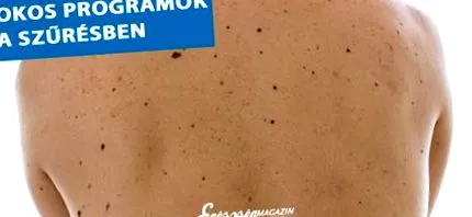 интелект скрининга