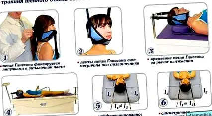 цервикална цервикална