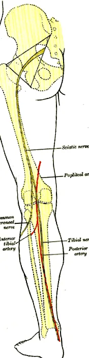 fracturii ligamentului popliteu