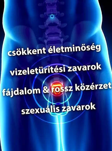 постове постове