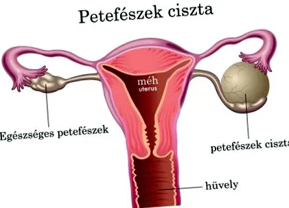 paraziți imagini