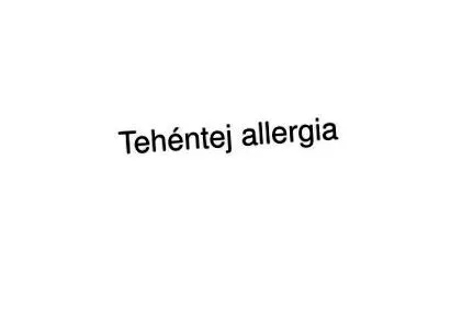 алергия презентация