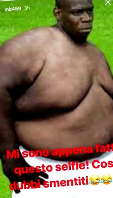 balotelli care