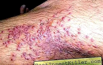 dermatitei petele