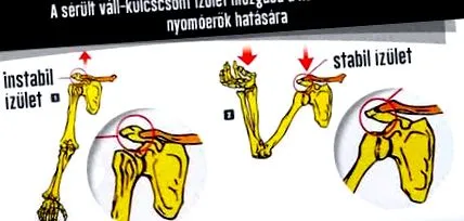 біль травми