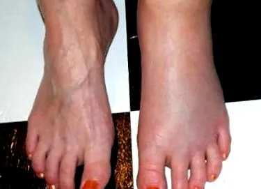 iulie dermatologul