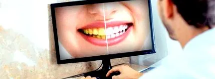 зубів artdent