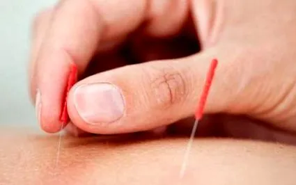 minden kell