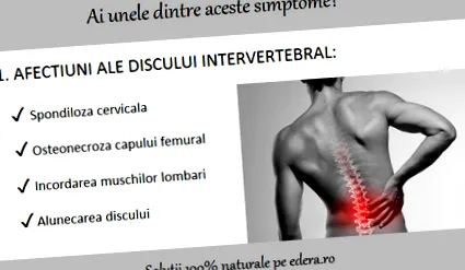intervertebrális lemez