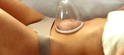 fogyásban