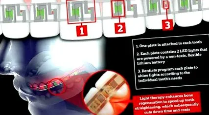 апарат печатен