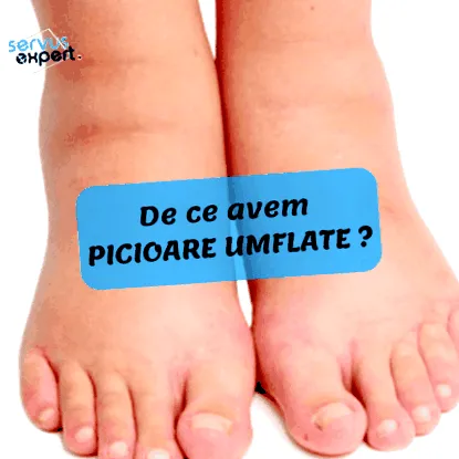 gyulladása ízületi gyulladás