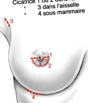 nélkül