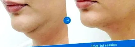 підборіддя