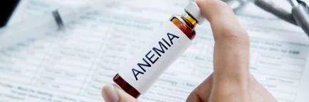 anémia anaemia