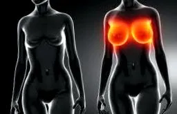 breast