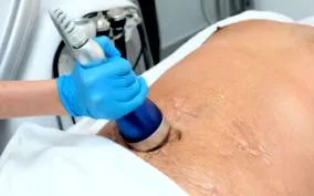 епицентарниот