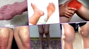 fájdalom