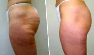Masaya Clinic