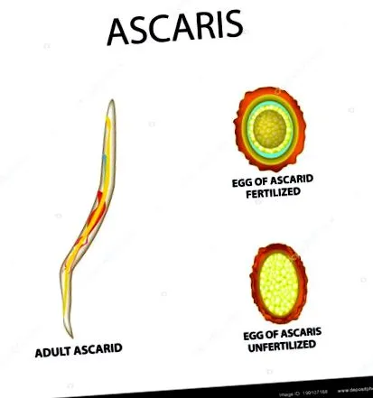 човешка инфекция Ascaris човешка