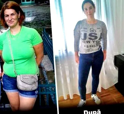 криолиполизата прави