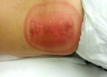 teszteltük